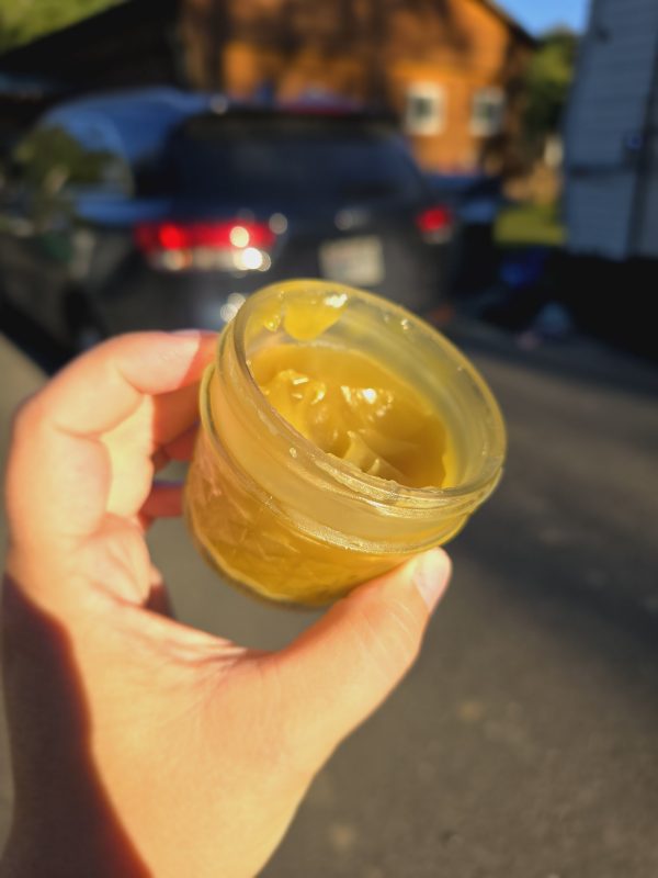 Burn Relief